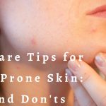 Skincare Tips for Acne-Prone Skin: Dos and Don’ts