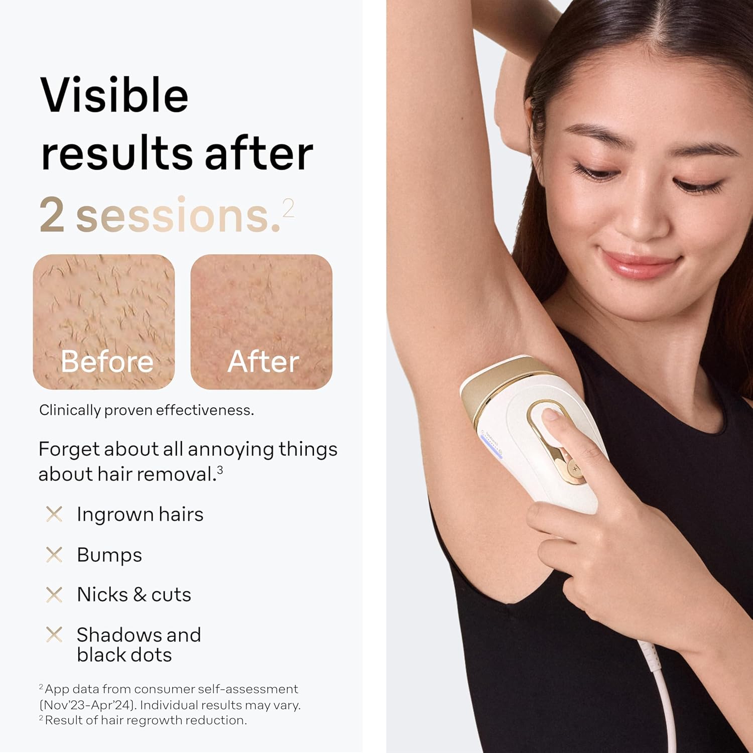 Braun Smart IPL hair removal
