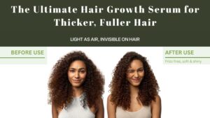Read more about the article The Ultimate 12 Best Hair Growth Serum for Thicker, Fuller Hair