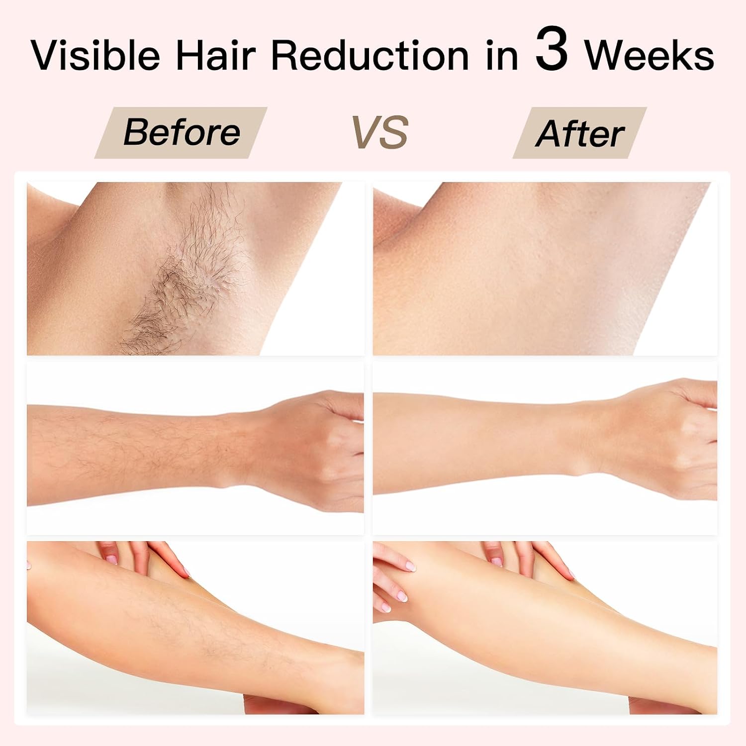 BoSidin IPL hair removal device for home beauty routines.