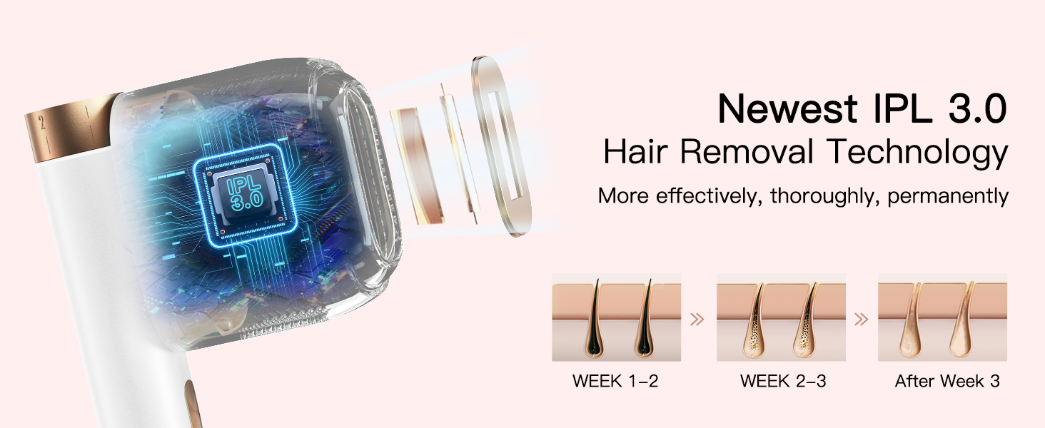BoSidin IPL hair removal product features and treatment functions.